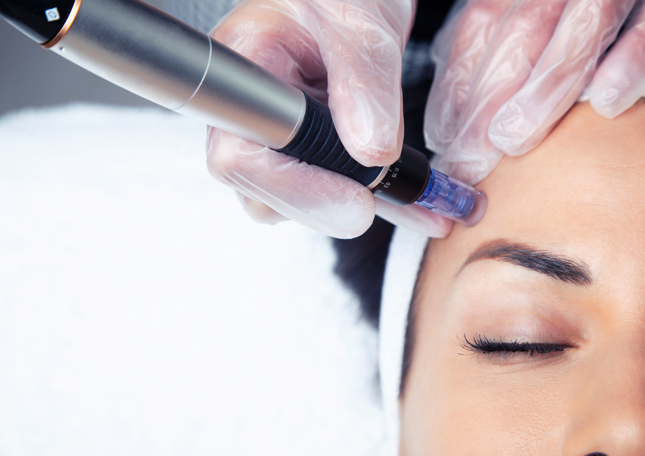 Operatrice esegue una mesoterapia sul viso con dispositivo