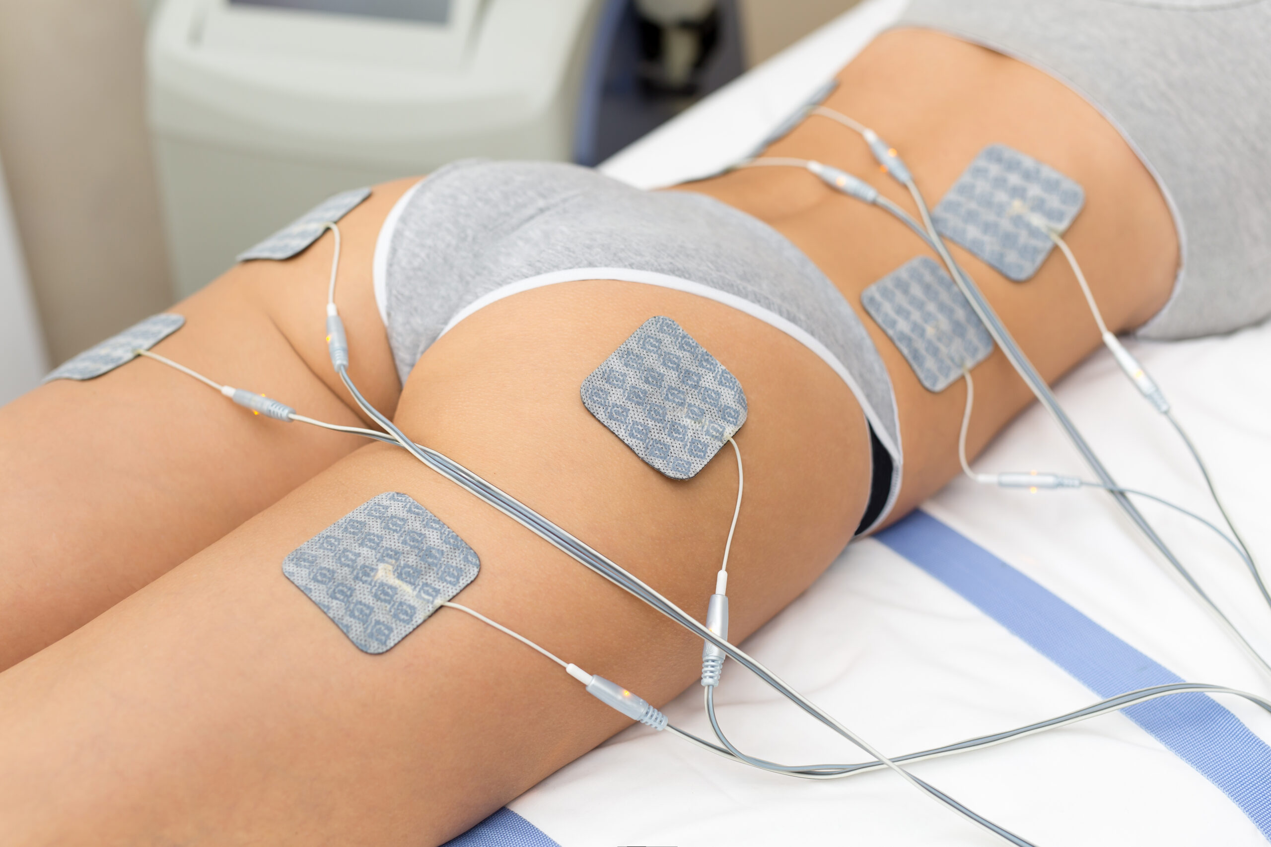 Elettrodi applicati sul corpo per il trattamento di elettrostimolazione