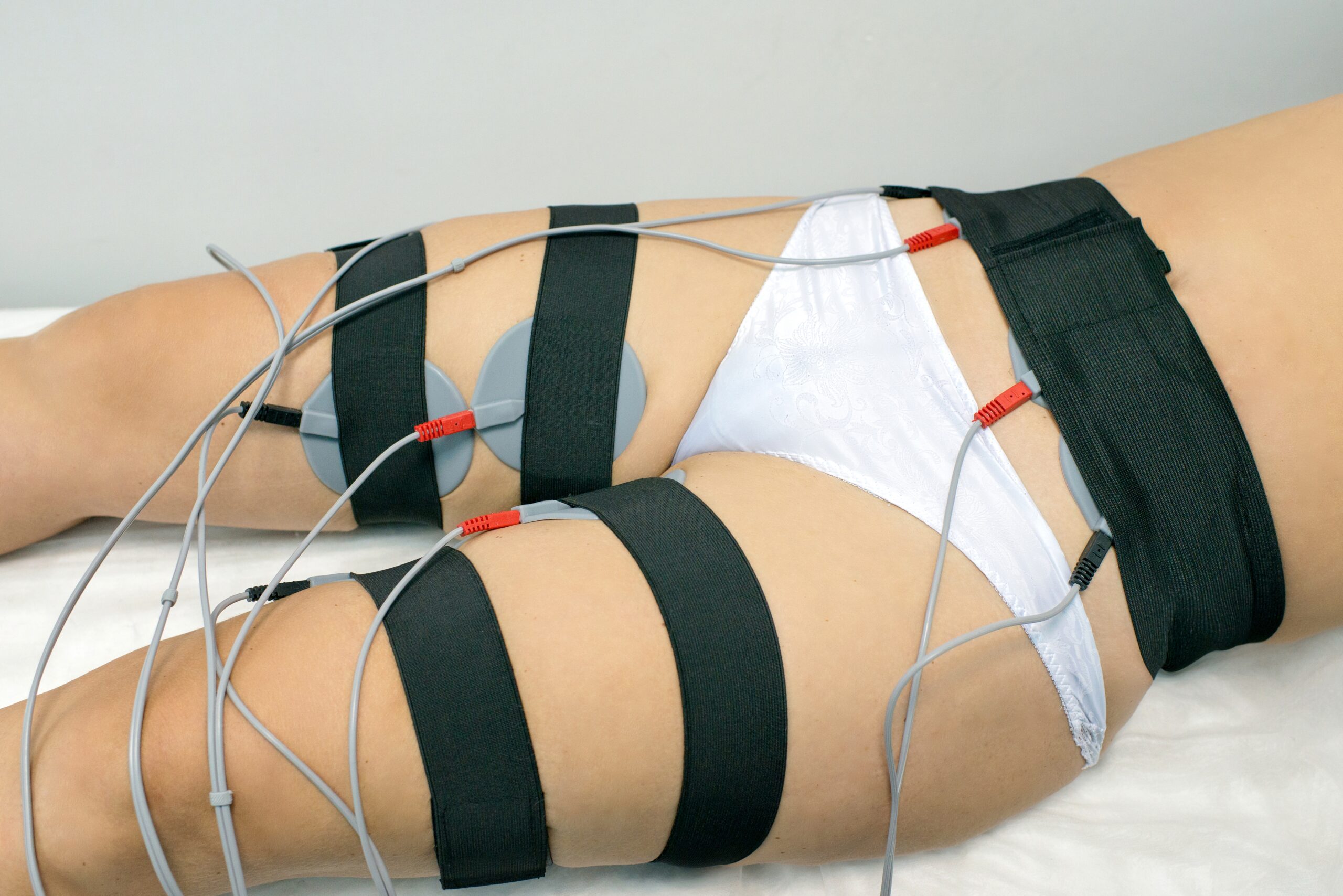 Donna riceve elettrostimolazione sulle gambe